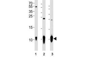 Western blot analysis of lysate from (1) A431 cell line, (2) mouse brain and (3) rat brain tissue using S100B antibody at 1:1000.