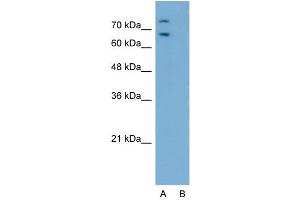 Host:  Rabbit  Target Name:  RORA  Sample Type:  Jurkat  Lane A:  Primary Antibody  Lane B:  Primary Antibody + Blocking Peptide  Primary Antibody Concentration:  2. (RORA anticorps  (Middle Region))