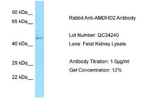 Host: Rabbit Target Name: AMDHD2 Sample Type: Fetal Kidney Antibody Dilution: 1. (AMDHD2 anticorps  (N-Term))