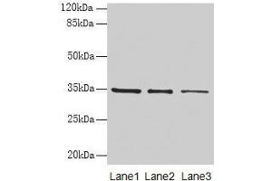 Western blot All lanes: GDF15 antibody at 4 μg/mL Lane 1: HepG2 whole cell lysate Lane 2: Human placenta tissue Lane 3: A549 whole cell lysate Secondary Goat polyclonal to rabbit IgG at 1/10000 dilution Predicted band size: 35 kDa Observed band size: 35 kDa (GDF15 anticorps  (AA 198-308))