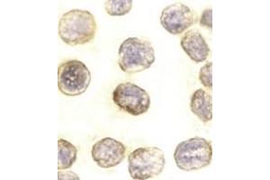 Immunocytochemistry of DAXX in HeLa cells with AP30275PU-N DAXX antibody at 10 μg/ml.