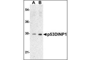 Western blot analysis of TP53INP1 expression in Human lung tissue lysate with AP30639PU-N TP53INP1 antibody at 0. (TP53INP1 anticorps  (N-Term))