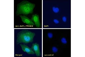 ABIN184913 Immunofluorescence analysis of paraformaldehyde fixed U2OS cells, permeabilized with 0. (KAP1 anticorps  (C-Term))