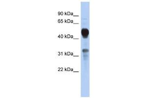 MVK antibody used at 1 ug/ml to detect target protein. (MVK anticorps  (Middle Region))