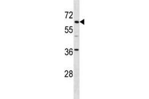 TFE3 antibody western blot analysis in mouse kidney tissue lysate. (TFE3 anticorps  (AA 489-516))