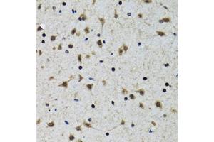 Immunohistochemistry of paraffin-embedded rat brain using SLC23A2 antibody (ABIN2559957) at dilution of 1:100 (40x lens). (SLC23A2 anticorps)