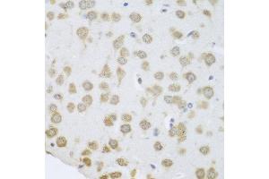 Immunohistochemistry of paraffin-embedded mouse brain using GRPEL2 antibody at dilution of 1:100 (40x lens). (GRPEL2 anticorps)
