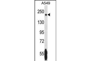 NRK anticorps  (AA 721-750)