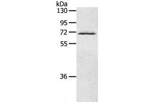 Western Blot analysis of Human fetal brain tissue using LTA4H Polyclonal Antibody at dilution of 1:500 (LTA4H anticorps)
