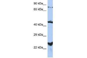 MRS2L antibody used at 1 ug/ml to detect target protein. (MRS2 anticorps  (Middle Region))