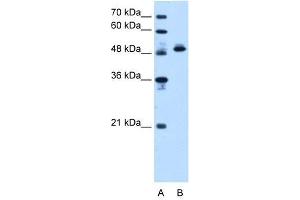 ATP5B antibody used at 1.