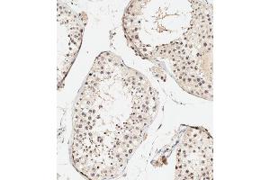 Immunohistochemical analysis of paraffin-embedded human testis tissue using (ABIN388841 and ABIN2839148) performed on the Leica® BOND RXm. (UBE4B anticorps  (N-Term))