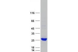 Validation with Western Blot