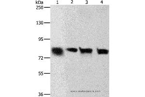 Western blot analysis of Hela and A549 cell, human liver cancer tissue and HT-29 cell, using CDH6 Polyclonal Antibody at dilution of 1:500 (CDH6 anticorps)
