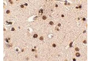 Immunohistochemistry of RIMS3 in human brain tissue with RIMS3 polyclonal antibody  at 2. (RIMS3 anticorps  (N-Term))