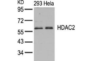 Image no. 3 for anti-Histone Deacetylase 2 (HDAC2) (AA 392-396) antibody (ABIN197336) (HDAC2 anticorps  (AA 392-396))