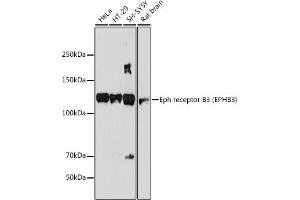 Western blot analysis of extracts of various cell lines, using Eph receptor B3 (EPHB3) (EPHB3) antibody (ABIN7266972) at 1:1000 dilution. (EPH Receptor B3 anticorps)