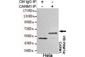Immunoprecipitation analysis of Hela cell lysates using PRMT4/CARM1 mouse mAb. (CARM1 anticorps)