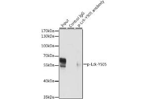 Immunoprecipitation analysis of 200 μg extracts of Jurkat cells, using 3 μg Phospho-Lck-Y505 pAb (ABIN3020027, ABIN3020028, ABIN3020029 and ABIN6225502).