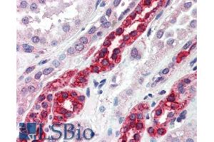 ABIN185453 (5µg/ml) staining of paraffin embedded Human Kidney. (GGA3 anticorps  (C-Term))