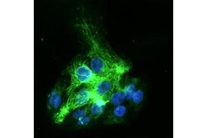 ICC/IF analysis of KRT19 in HepG2 cells line, stained with DAPI (Blue) for nucleus staining and monoclonal anti-human HepG2 antibody (1:100) with goat anti-mouse IgG-Alexa fluor 488 conjugate (Green).