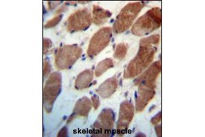 TRIM54 Antibody (N-term) (ABIN657215 and ABIN2846323) immunohistochemistry analysis in formalin fixed and paraffin embedded human skeletal muscle followed by peroxidase conjugation of the secondary antibody and DAB staining. (TRIM54 anticorps  (N-Term))