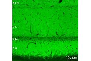 Indirect immunolabeling of PFA fixed rat hippocampus sections. (Piccolo anticorps  (AA 4439-4776))