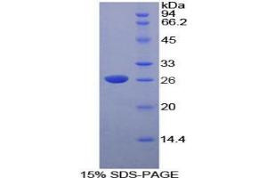 SDS-PAGE analysis of Rat DNASE1L2 Protein. (DNASE1L2 Protéine)