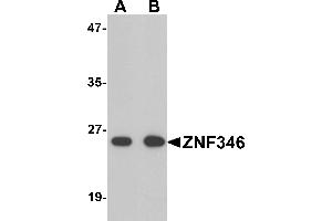 Western blot analysis of TRIP6 in EL4 cell lysate with TRIP6 antibody at 1 µg/mL. (ZNF346 anticorps  (N-Term))