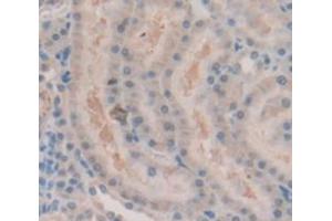 IHC-P analysis of Rat Tissue, with DAB staining. (Androgen Receptor anticorps  (AA 765-902))