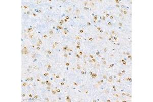 Immunohistochemistry of paraffin embedded rat brain using MAP7 (ABIN7074621) at dilution of 1:600 (300x lens) (MAP7 anticorps)