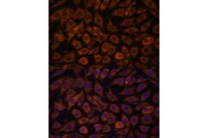 Immunofluorescence analysis of L929 cells using TLR3 antibody (ABIN6130066, ABIN6149219, ABIN6149220 and ABIN6215465) at dilution of 1:100.