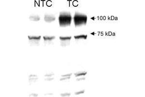 Human AGGF1 detected in HT1080 non-transfected cell lysate (NTC) and HT1080 transfected cell lysate (TC) using AGGF1 polyclonal antibody . (AGGF1 anticorps)