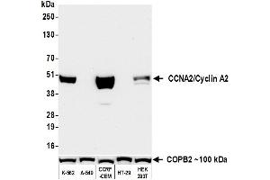 Western Blotting (WB) image for anti-Cyclin A2 (CCNA2) (C-Term) antibody (ABIN7795811)