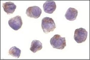 Immunocytochemistry of RICK in A431 cells with this product at 10 μg/ml.