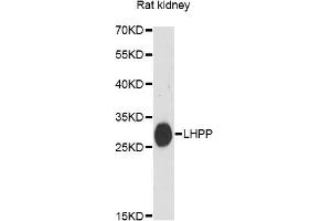 Western blot analysis of extracts of rat kidney, using LHPP antibody (ABIN6292546) at 1:3000 dilution.