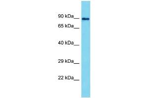 Host: Rabbit  Target Name: Mapk8ip2  Sample Tissue: Rat Testis lysates  Antibody Dilution: 1. (IB2 anticorps  (Middle Region))