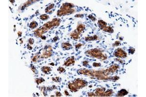 Immunohistochemical staining of paraffin-embedded Human breast tissue using anti-AK5 mouse monoclonal antibody. (Adenylate Kinase 5 anticorps)
