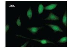 Immunostaining analysis in HeLa cells.