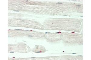 anti-PR Domain Containing 13 (PRDM13) (AA 2-36), (N-Term) antibody