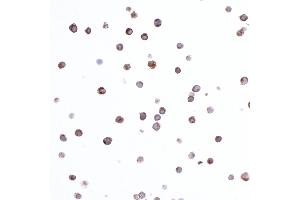 Immunocytochemistry (ICC) image for anti-HLA-DR-gamma (CD74) antibody (ABIN7449435)