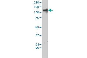 TRIM24 monoclonal antibody (M01), clone 2F2 Western Blot analysis of TRIM24 expression in IMR-32 . (TRIM24 anticorps  (AA 432-569))