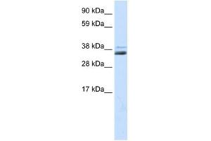 SFRP1 antibody (20R-1319) used at 0.