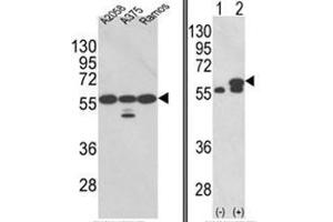 (LEFT) Western blot analysis of PDIA3 Antibody (Center) in A2058, A375, Ramos cell line lysates (35ug/lane). (PDIA3 anticorps  (Middle Region))