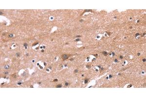 Immunohistochemistry of paraffin-embedded Human brain tissue using PIP5K1B Polyclonal Antibody at dilution 1:30