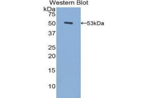 Detection of Recombinant FGB, Human using Polyclonal Antibody to Fibrinogen Beta Chain (FGB) (Fibrinogen beta Chain anticorps  (AA 45-491))