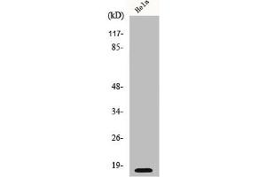 Western Blot analysis of HeLa cells using p16 Polyclonal Antibody (CDKN2A anticorps  (N-Term))