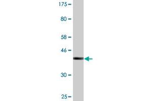 Western Blot detection against Immunogen (36. (SSH1 anticorps  (AA 752-849))