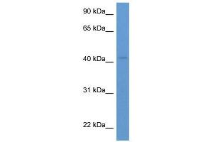 Western Blot showing HSH2D antibody used at a concentration of 1-2 ug/ml to detect its target protein. (HSH2D anticorps  (C-Term))