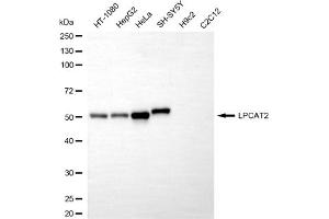 Western blotting analysis using LPCAT2 antibody (ABIN7799306).